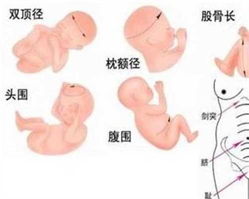 代孕和试管婴儿区别_孕产_做泰国试管婴儿生双胞