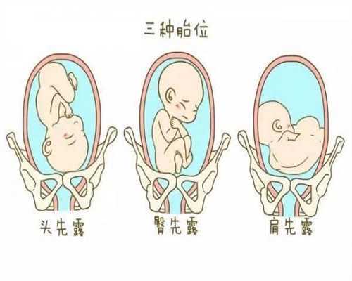 深圳2019私人代孕_试管婴儿三个重要阶段的饮食黄
