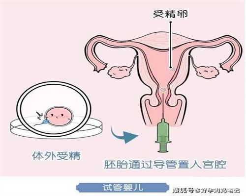 深圳2020年代孕的价格_深圳代孕的女人哪里找