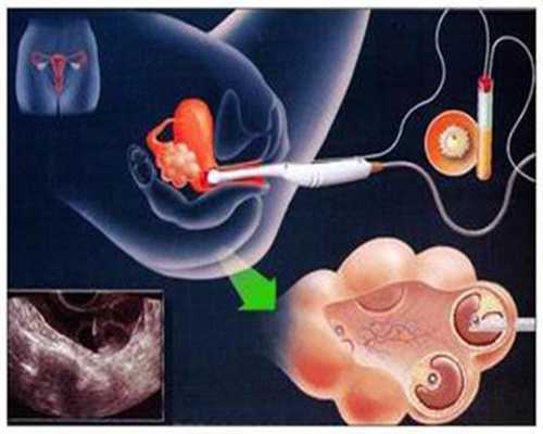 代孕网-代孕网怎么样-代孕2个月胃酸怎么办