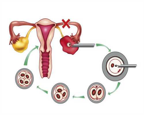 代孕网_代孕移植后反应_孕囊多大的时候会出现胎芽和胎心